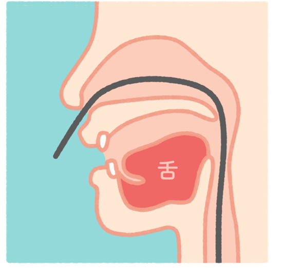 鼻からの内視鏡検査